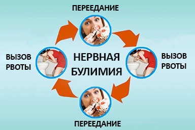 Лечение булимии в Рыбном